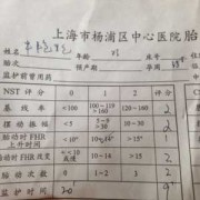 胎儿fhr是什么意思（胎儿FHR是什么意思呢）