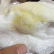 孕期溢乳是什么颜色（孕期溢乳是什么颜色的）
