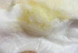 孕期溢乳是什么颜色（孕期溢乳是什么颜色的）