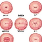打胎儿需要多少钱（打胎儿需要多少钱?）