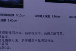 4个月胎儿心跳（怀孕3个月胎儿心跳次数正常是多少）