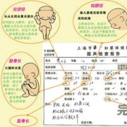 胎儿b超图详解（胎儿b超图详解图片）