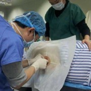 剖腹产全麻对胎儿智力（剖腹产脊椎打麻药疼吗）