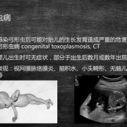 孕妇感染弓形虫后会有哪些症状,孕晚期弓形虫对胎儿的影响