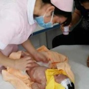 孕期畸形（孕期畸形）
