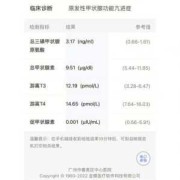 孕妇甲亢会影响胎儿吗（孕妇甲亢会影响胎儿吗吃药丙基硫嘧啶）