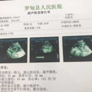 怀孕18周做什么检查,18周胎儿彩超图片