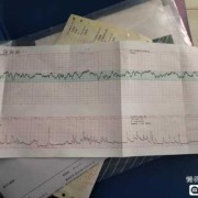 胎儿动时胎心超过160（孕晚期胎心超过160是属于正常的吗）