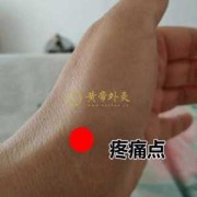 孕期手腕疼（孕期手腕疼是什么原因）