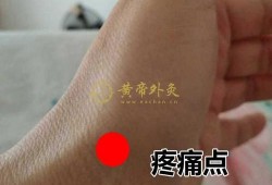 孕期手腕疼（孕期手腕疼是什么原因）