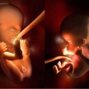 怀孕12周宝宝在肚子哪个位置,孕12周胎儿大小标准