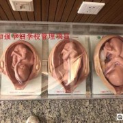 2个月的胎儿有多大（宝宝才2个月多，摸着宝宝的后背发热是什么原因呢？我很担心）