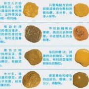 怀孕后大便次数多怎么回事,孕期总想大便怎么回事