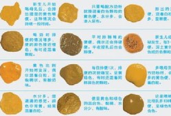 怀孕后大便次数多怎么回事,孕期总想大便怎么回事
