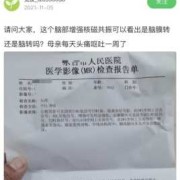 四个月宝宝做头颅核磁共振需要注意什么,胎儿磁共振多少钱一次