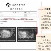 怀孕8周b超图胎儿胎心多少才正常？每次孕检都能听到宝宝心跳,7周胎儿心跳多少正常