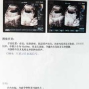 怀孕83天是几周和几个月啊,怀孕83天