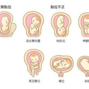 胎儿前肩（胎儿前肩是哪个部位）