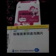 怀孕期间得了霉菌该怎么办,孕期霉菌用什么药效果好