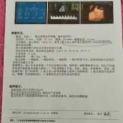 胎儿右心室强回声光斑（胎儿右心室强回声光斑）