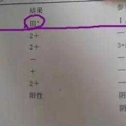 霉菌阴道炎能顺产吗,孕期有霉菌可以顺产吗有影响吗