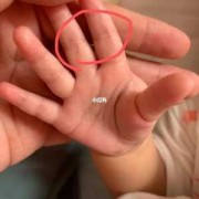 惊吓对胎儿（婴儿受惊吓后有什么反应）