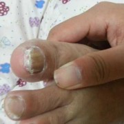 胎儿吃脚趾（胎儿吃脚趾头是怎么回事）