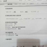 abo溶血几周开始检查,孕期血溶检查多少钱