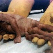 21周引产胎儿图片（21周引产胎儿图片）
