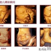 四维彩超对胎儿的影响（四维不过关是什么原因啊？刚做的检查了，这样胎儿会发育不好吗）