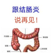 孕期结肠炎（孕期结肠炎怎么办）