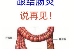 孕期结肠炎（孕期结肠炎怎么办）