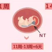 胎儿nt指（t和nt是啥意思）