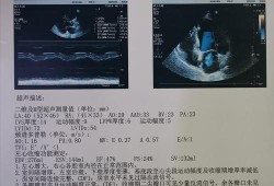 有必要做胎儿心脏彩超吗（有必要做胎儿心脏彩超吗?）