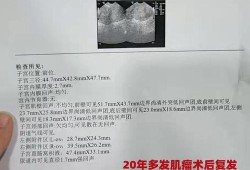怀孕后检查出子宫肌瘤有影响吗,怀孕期间查出子宫肌瘤危险吗
