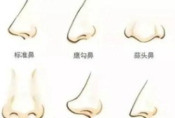 婴儿鼻型如何判断鼻梁高,胎儿鼻子高是男孩女孩