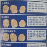 胎儿颅骨畸形（胎儿颅骨畸形的原因）