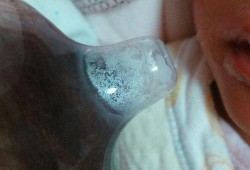 孕期乳头硬（喂完奶乳头硬硬的痒痒的正常么）