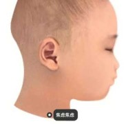 胎儿头围小怎么办（两个月宝宝头蹭来蹭去的是怎么回事啊）