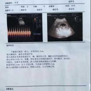 怀孕胎儿比实际天数小（为什么怀孕实际天数跟B超不一样）