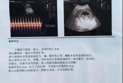 怀孕胎儿比实际天数小（为什么怀孕实际天数跟B超不一样）