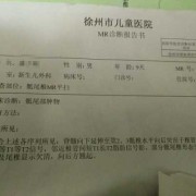 婴儿脊柱裂的症状有什么,胎儿脊柱裂超声表现报告单
