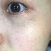 怀孕初期可以化妆吗？我皮肤很不好，到底怎么护理合适啊,孕期皮肤差怎么办呢