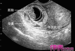 胎芽什么时候变成胎儿（胎芽是什么）