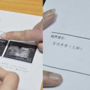 备孕期间可以做彩超吗（备孕期间可以做彩超吗女）