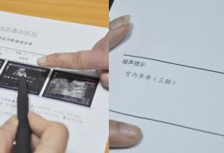 备孕期间可以做彩超吗（备孕期间可以做彩超吗女）