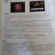 胎儿血管（胎儿血管走向异常严重吗）