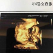怀孕23周胎儿彩超图（怀孕23周胎儿彩超图片）