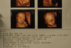 孕期b超做多了会影响胎儿吗（孕晚期多久做一次b超合适？做多了对胎儿有影响吗）