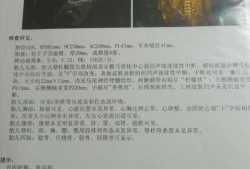 婴儿脊柱裂的症状有什么,胎儿脊柱裂超声表现报告单
